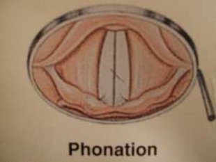 Usachen-Stimmstörung.